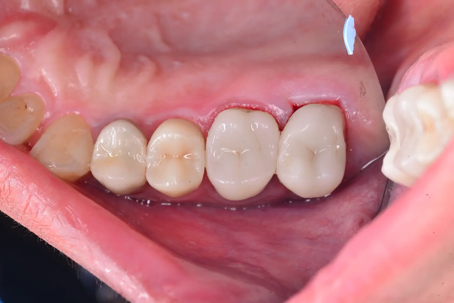 dr-abdulla-1-after.webp