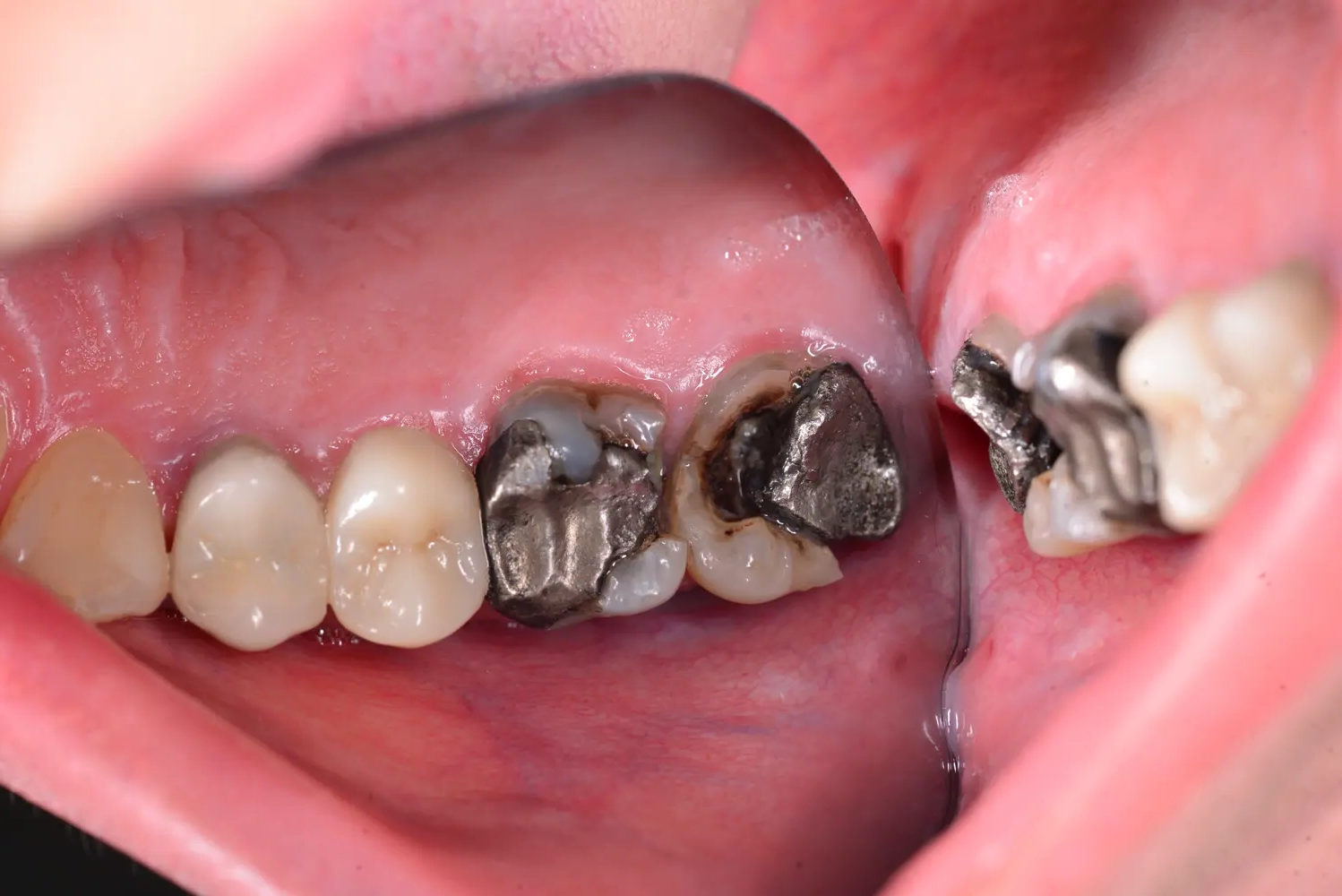 Before Image