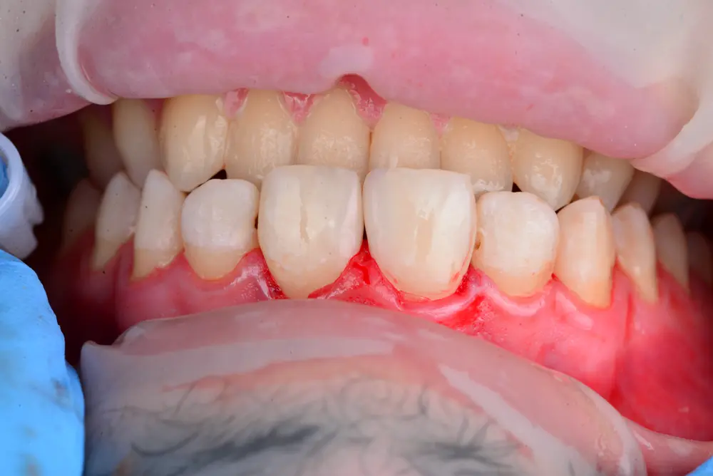 dr-abdulla-2-after.webp