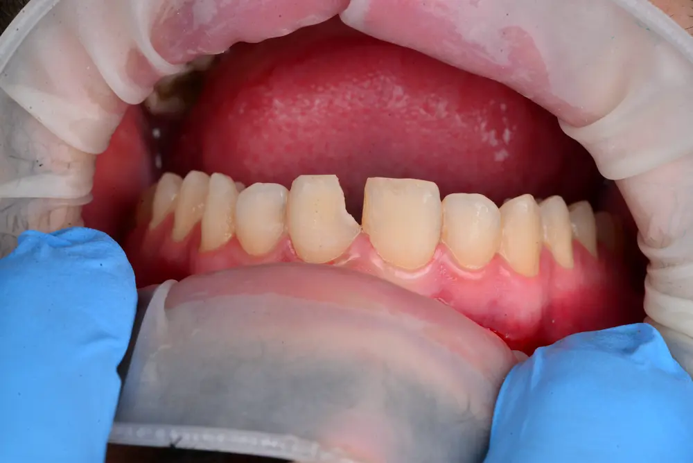 Before Image
