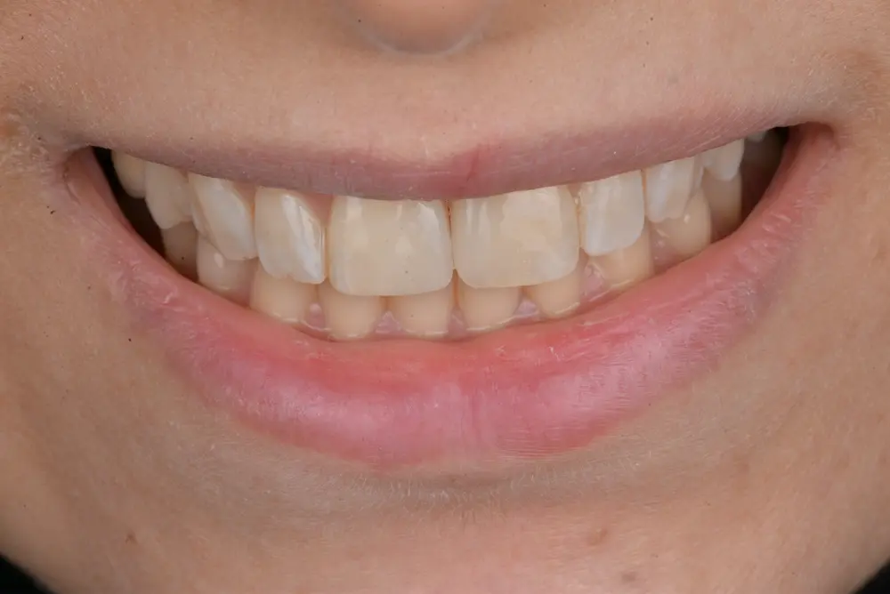 dr-abdulla-3-after.webp