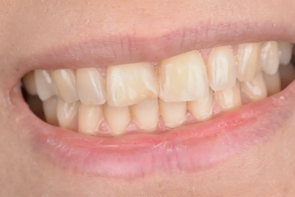 Before Image