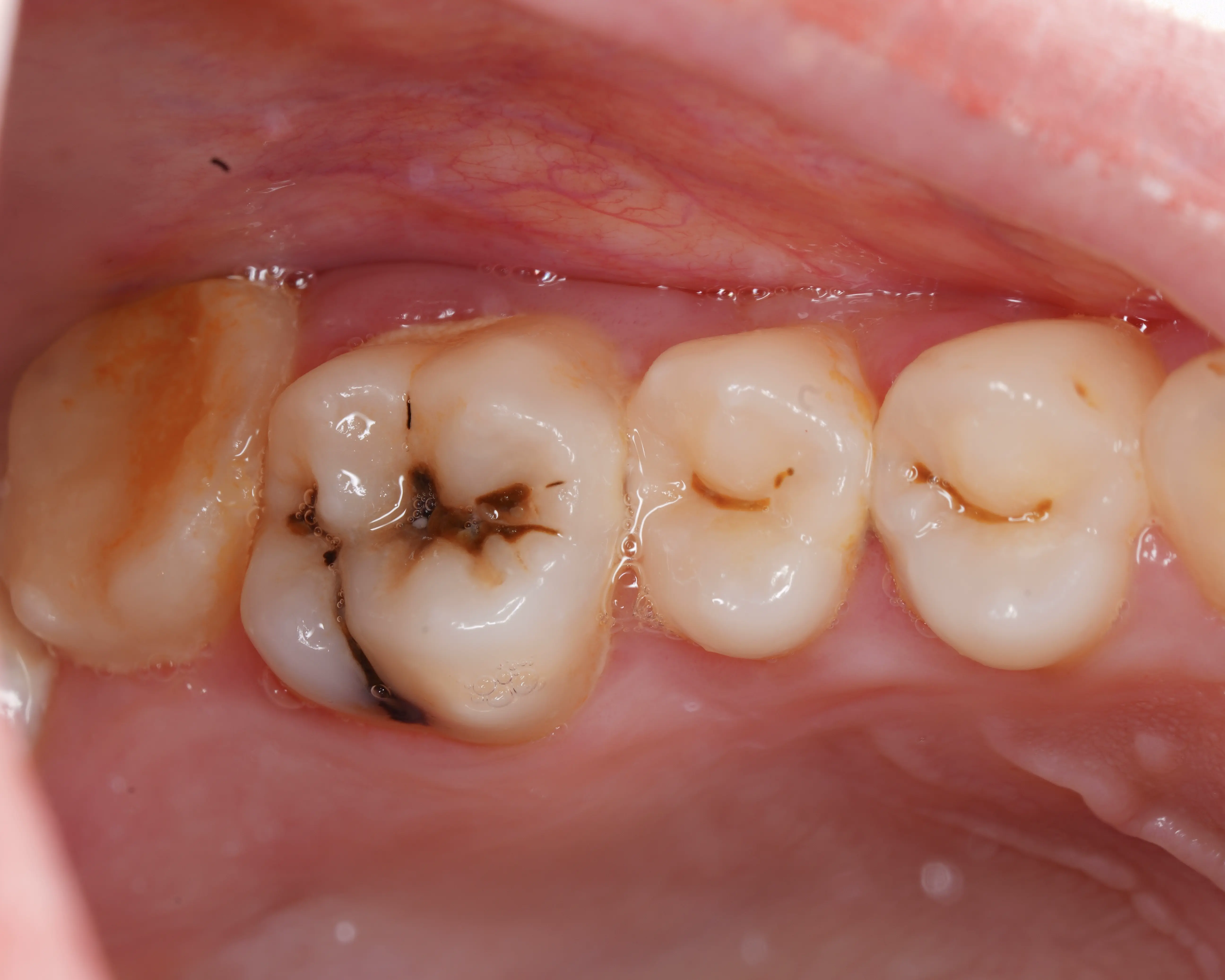 Before Image