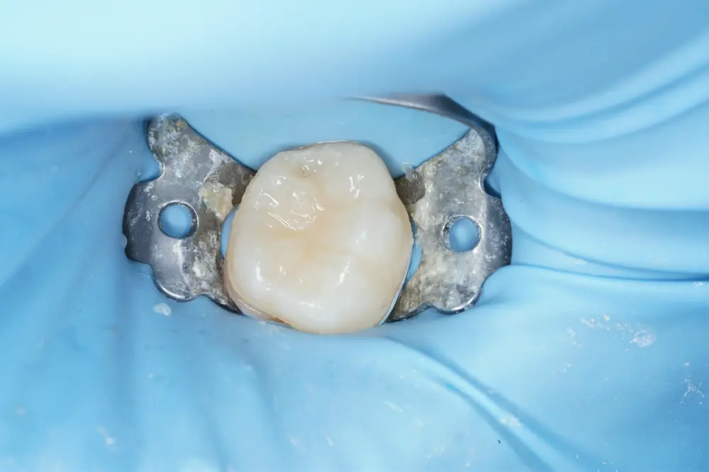 dr-ahmed-1-after.webp