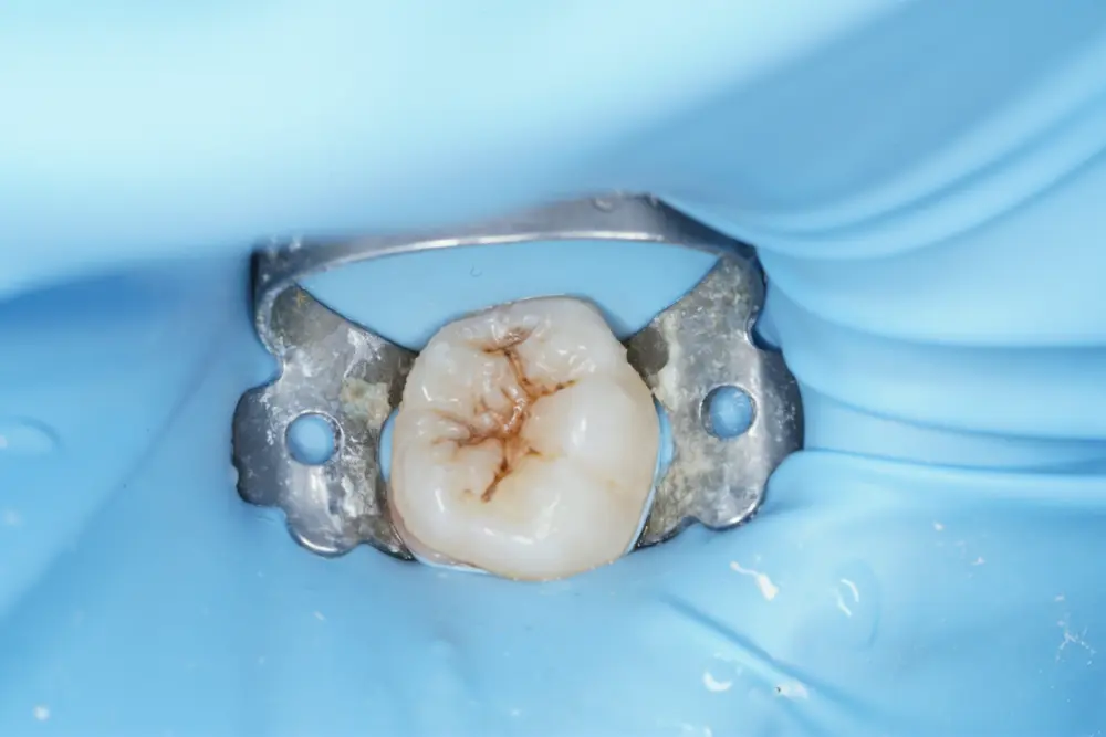 Before Image