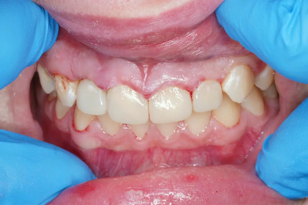 dr-ahmed-2-after.webp