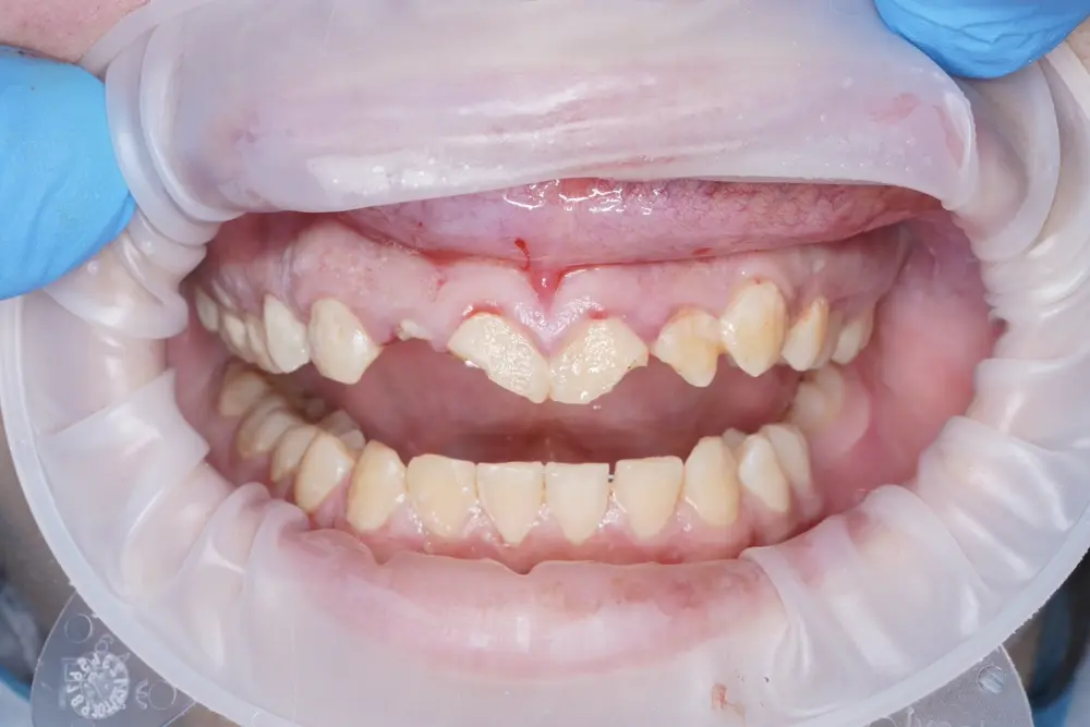 Before Image