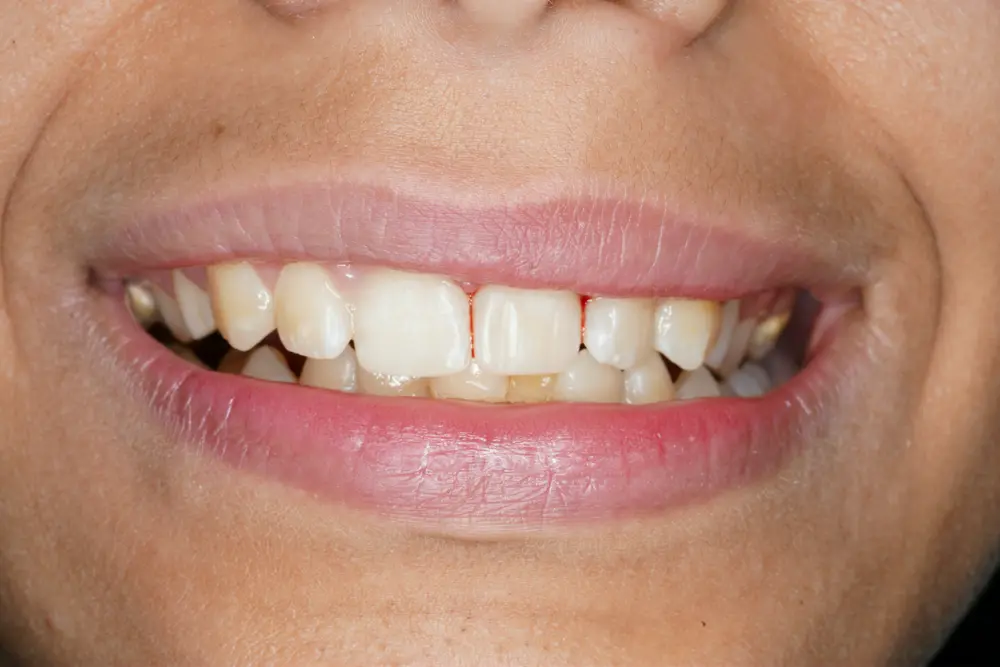 dr-ahmed-3-after.webp
