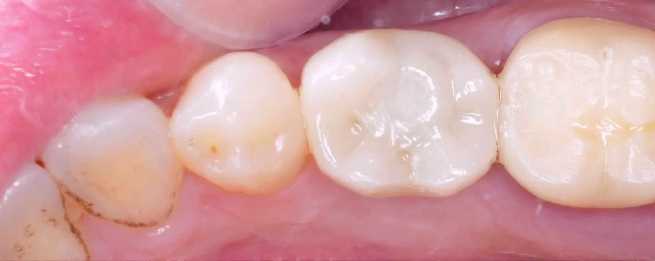 dr-ahmed-jamil-1-after.webp
