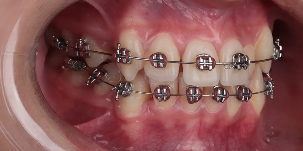 dr-alaa-1-after.webp