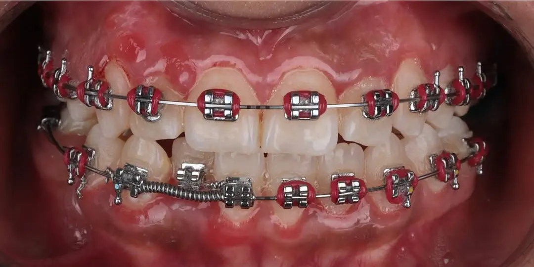 dr-alaa-2-after.webp