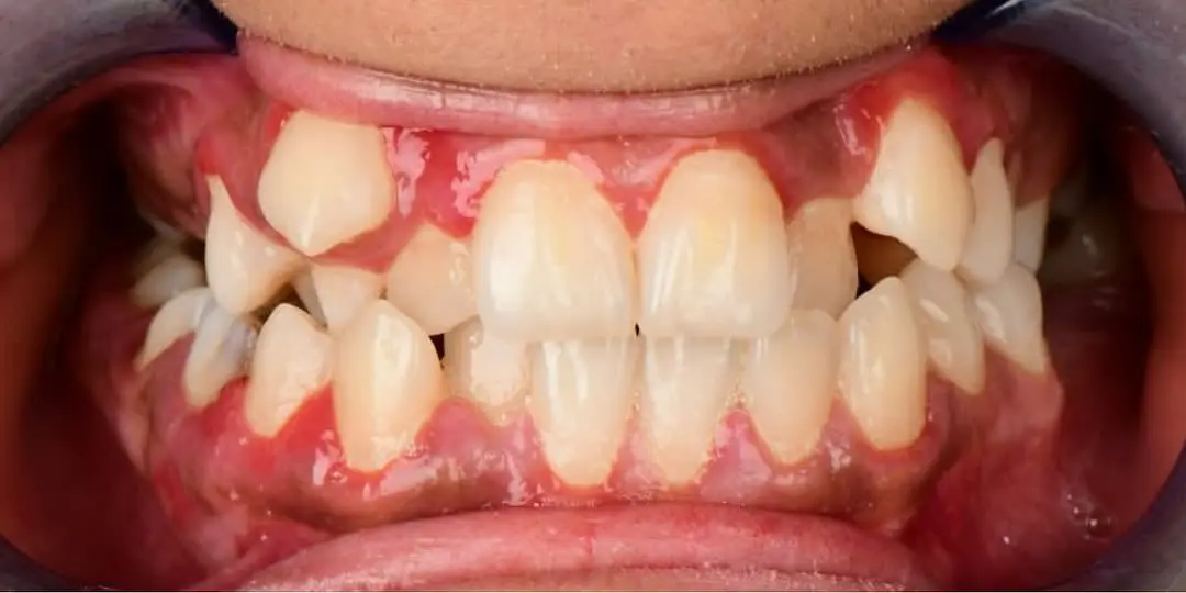Before Image