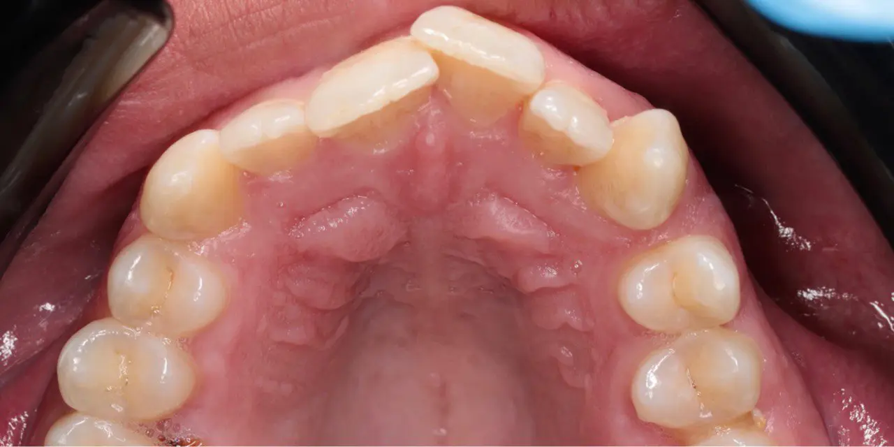 Before Image
