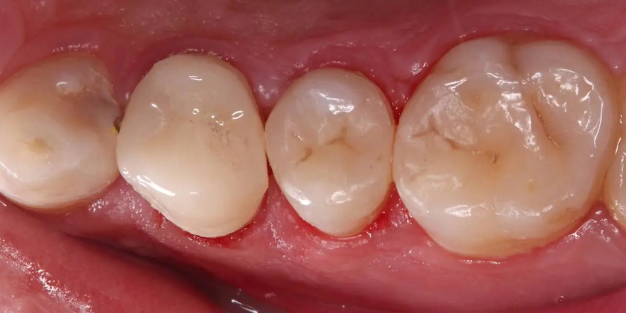 dr-ayub-1-after.webp