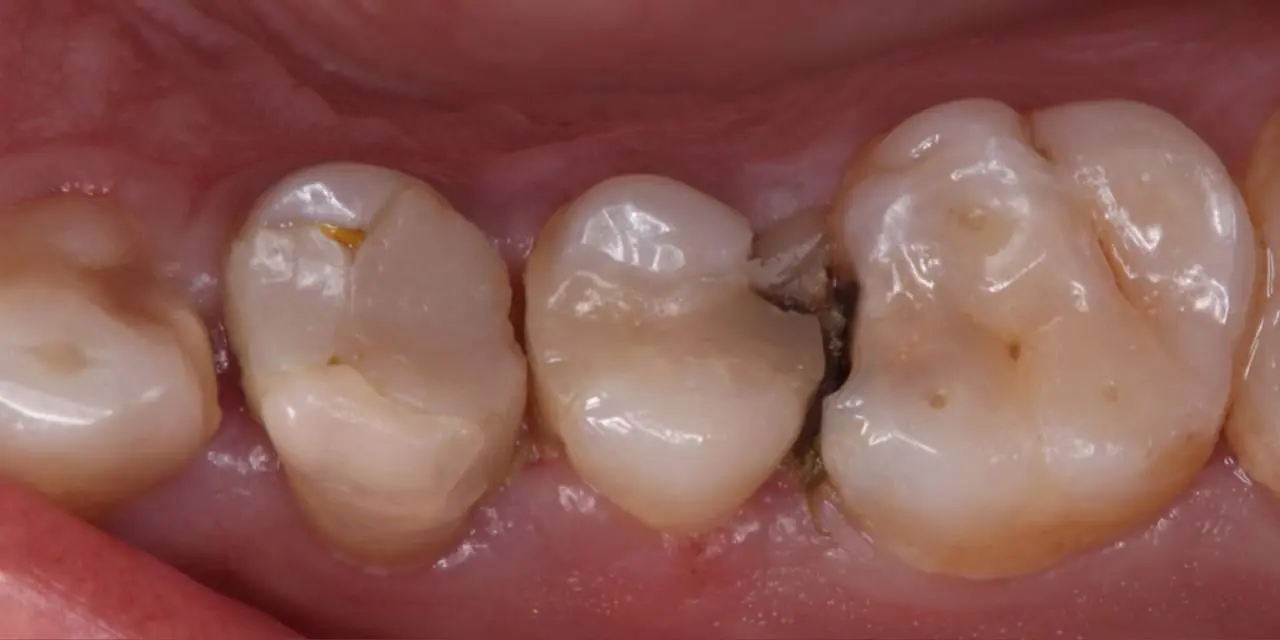 Before Image