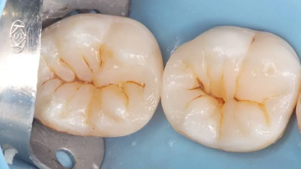 dr-ayub-2-after.webp