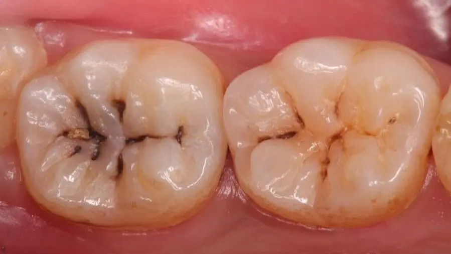 Before Image