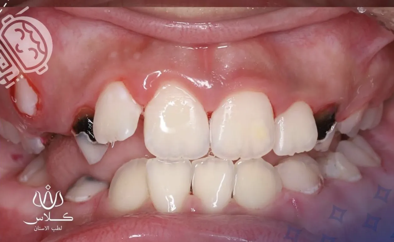 dr-batool-1-after.webp