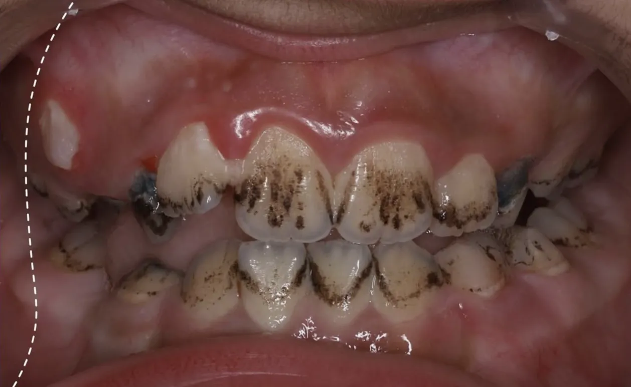 Before Image