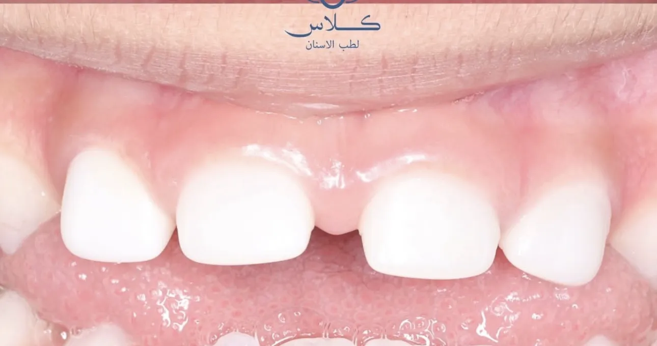 dr-batool-2-after.webp