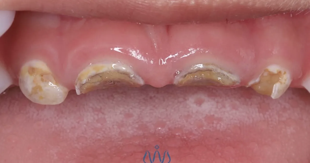 Before Image