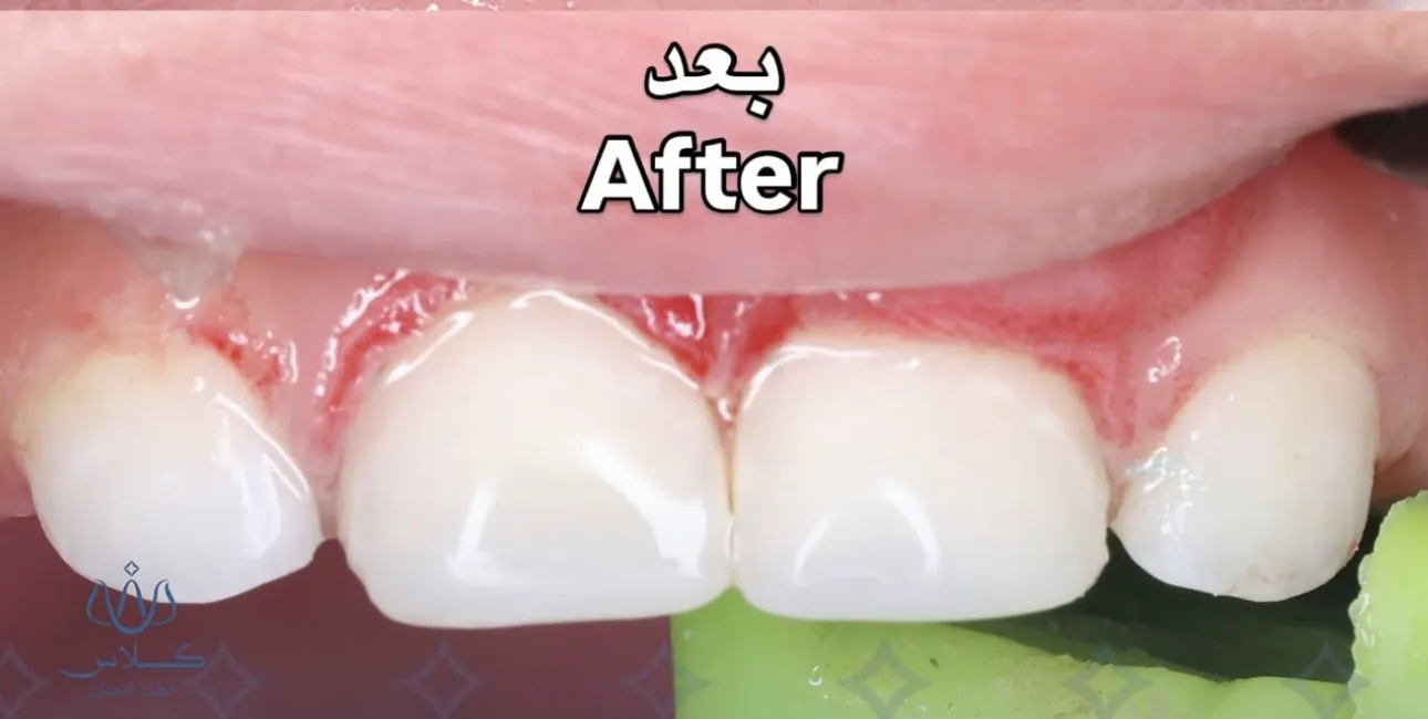 dr-batool-3-after.webp
