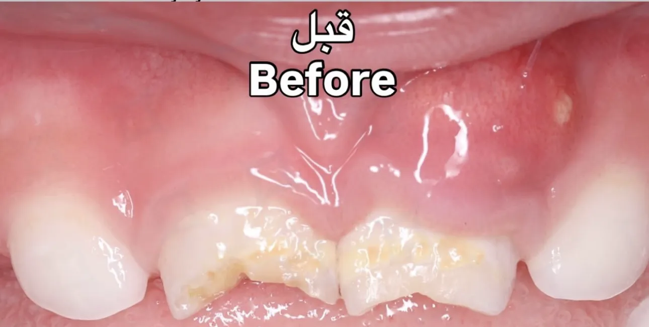 Before Image
