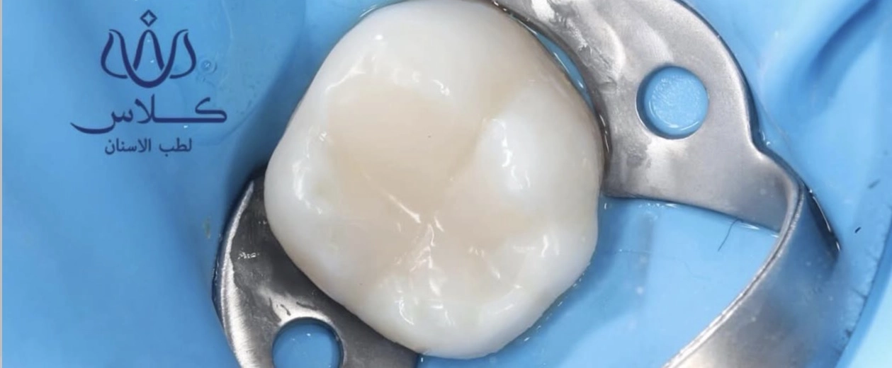dr-batool-4-after.webp