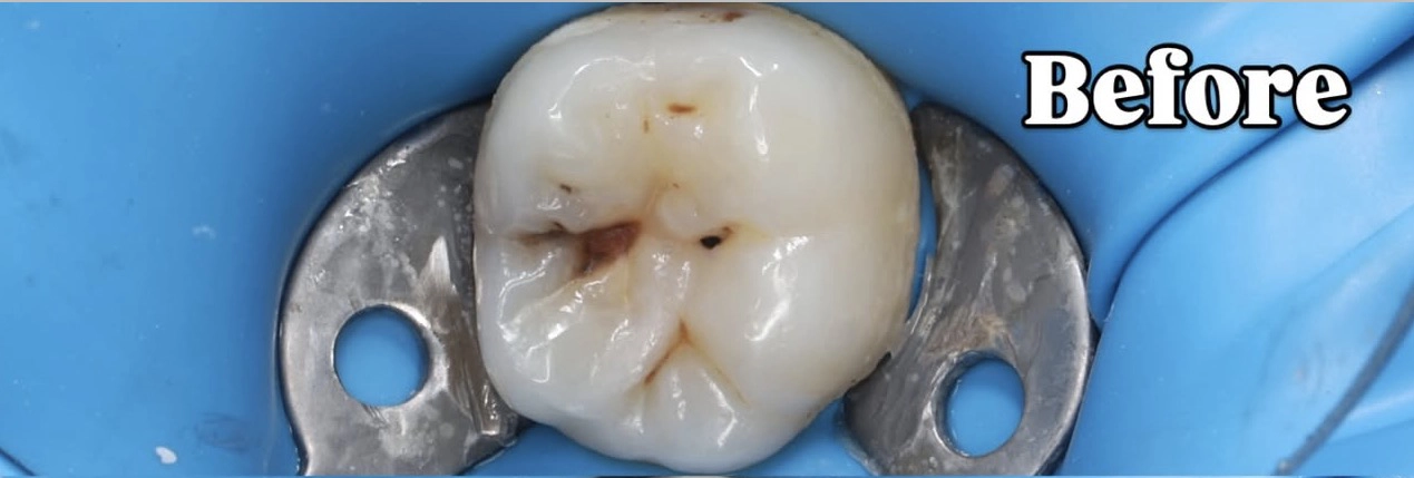 Before Image