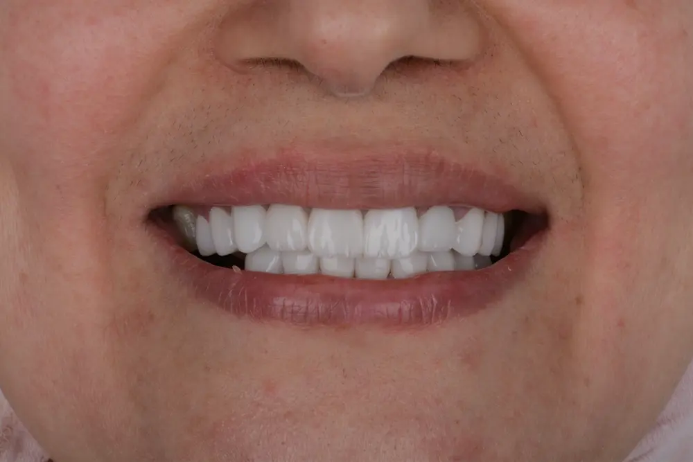 dr-khalid-1-after.webp