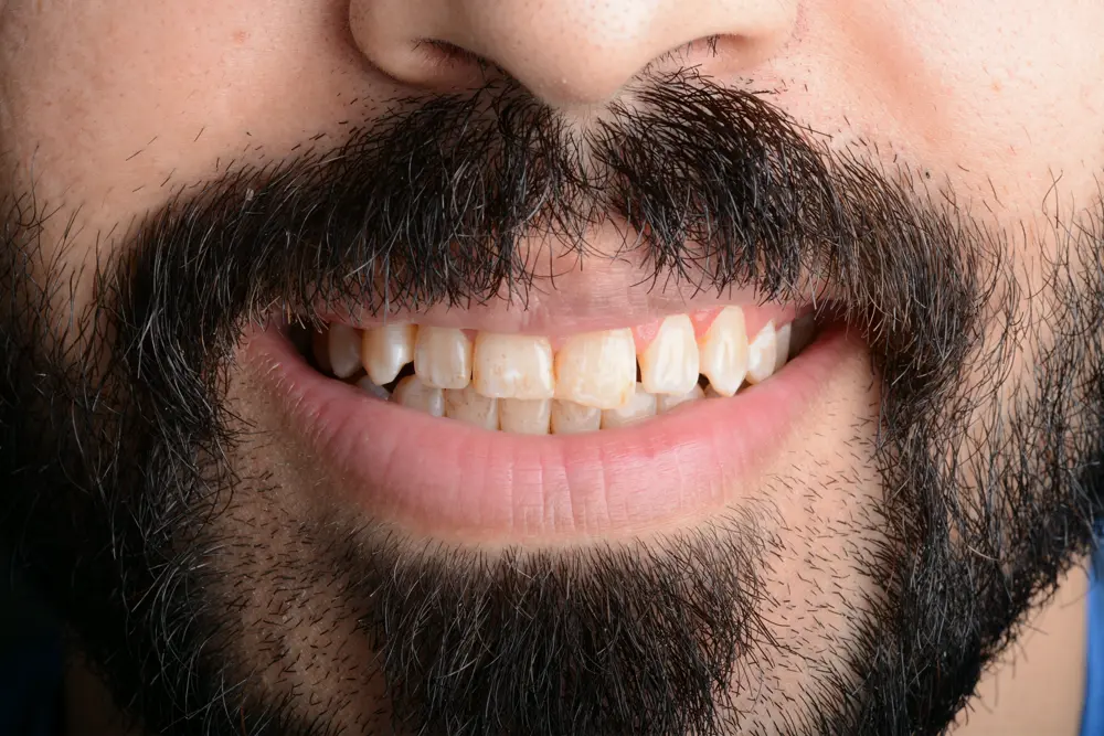 Before Image
