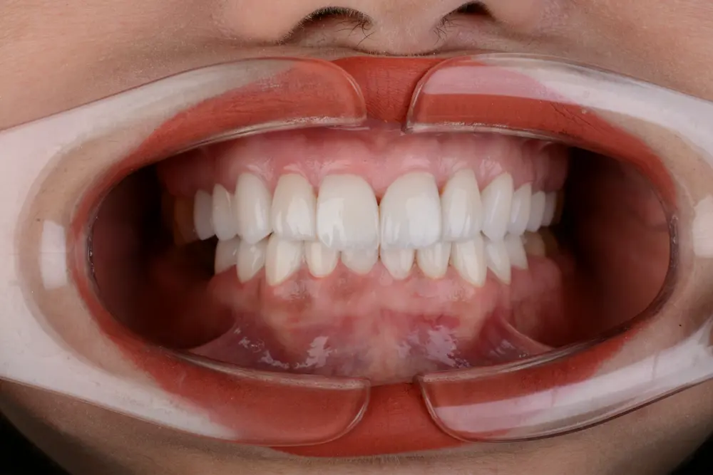 dr-khalid-6-after.webp