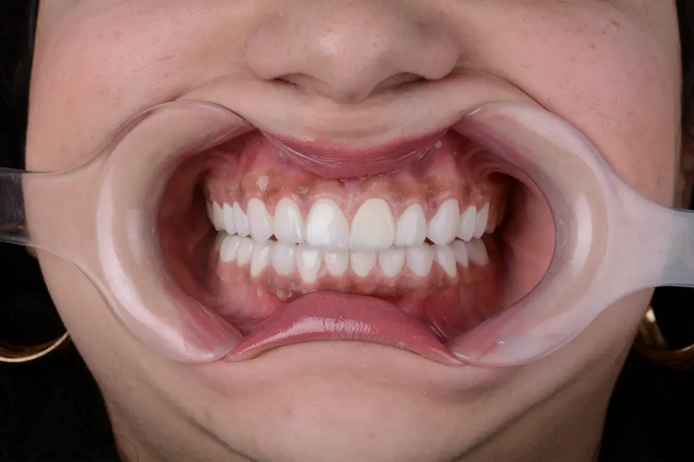 dr-khalid-7-after.webp