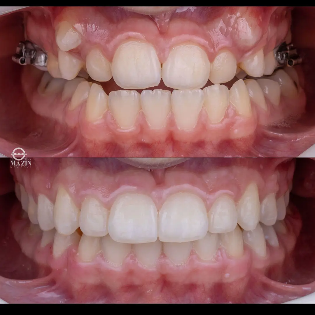 Before Image