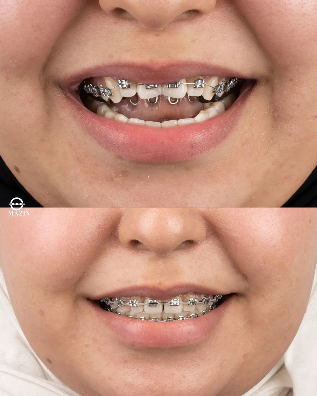 Before Image
