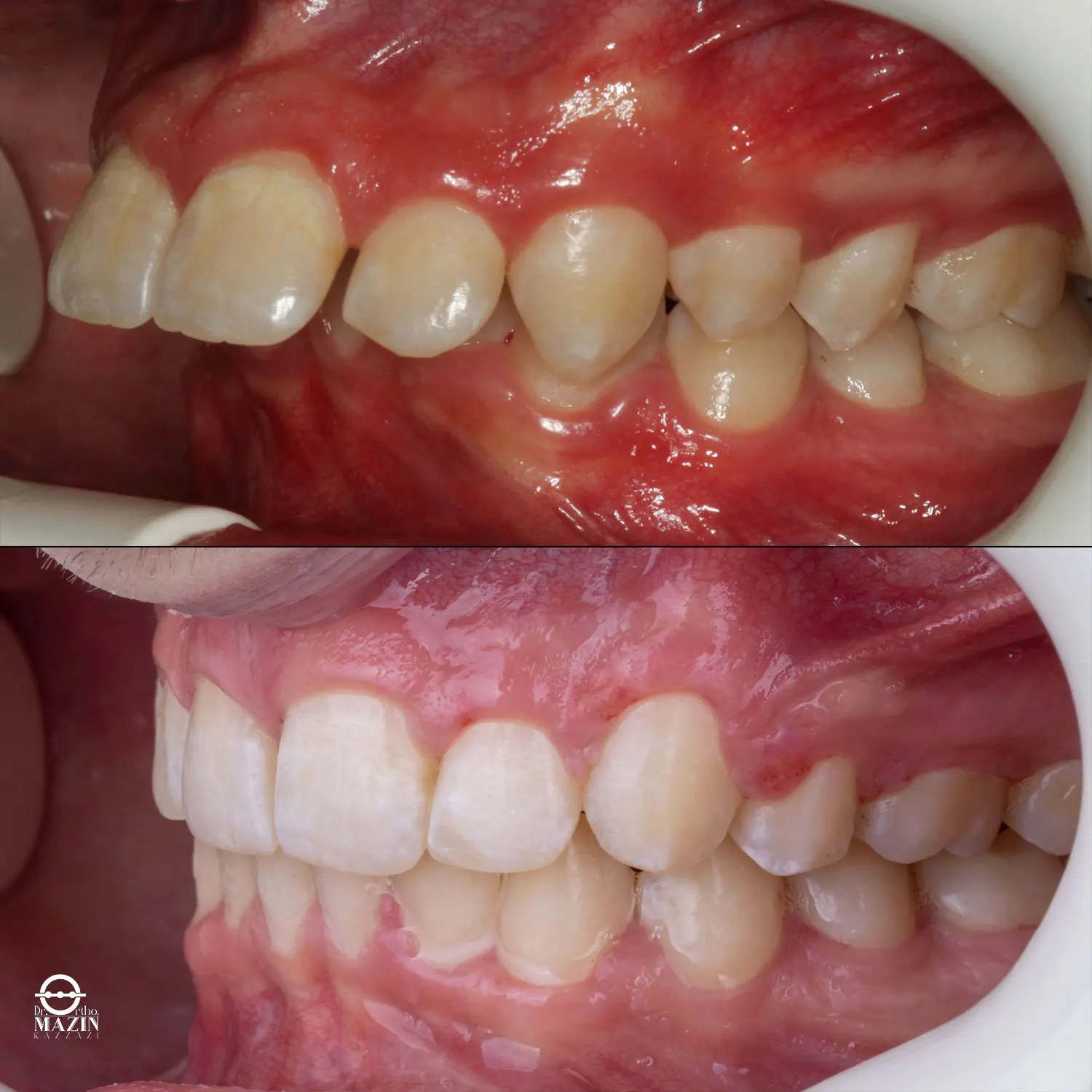 Before Image