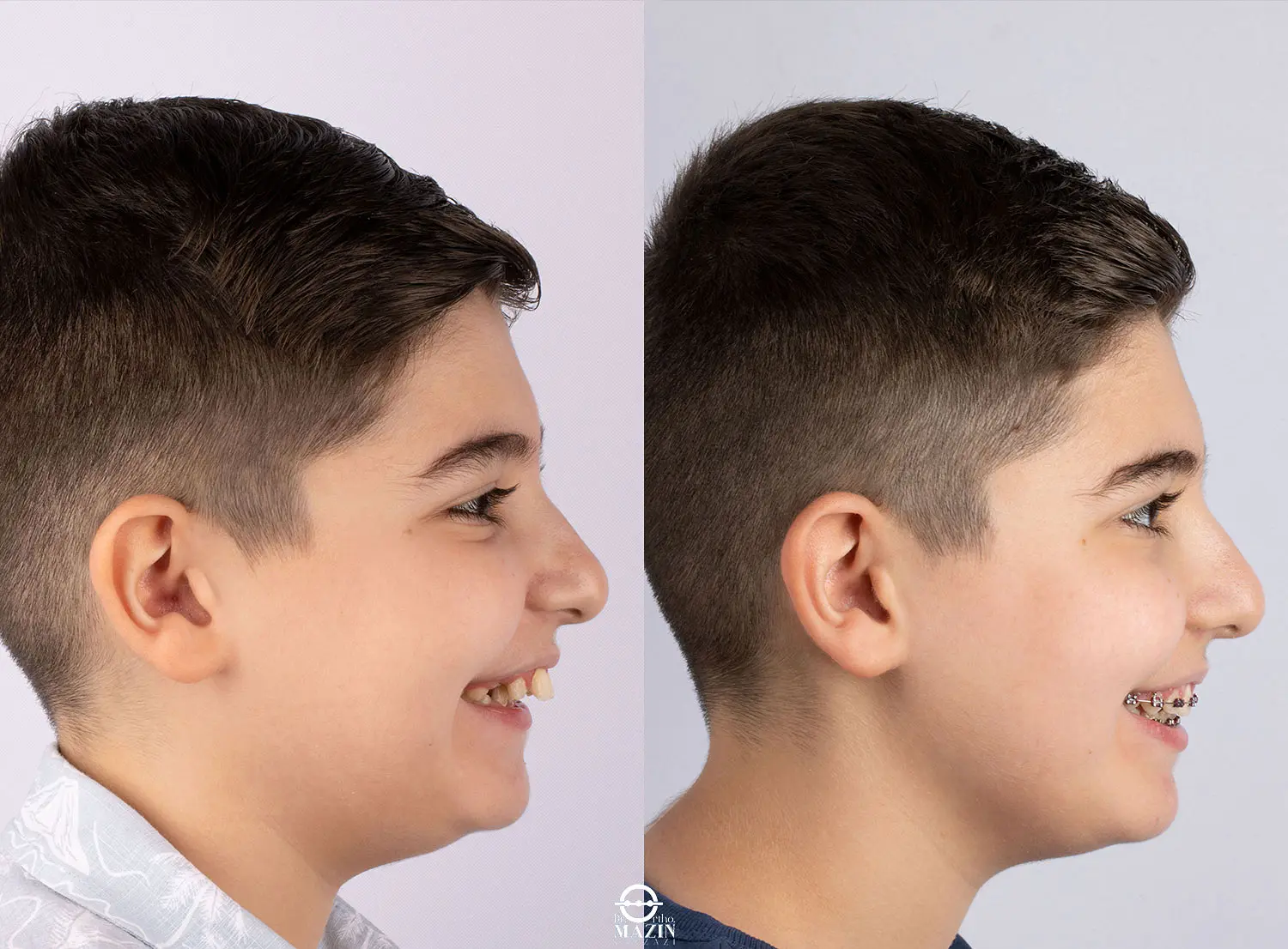Before Image