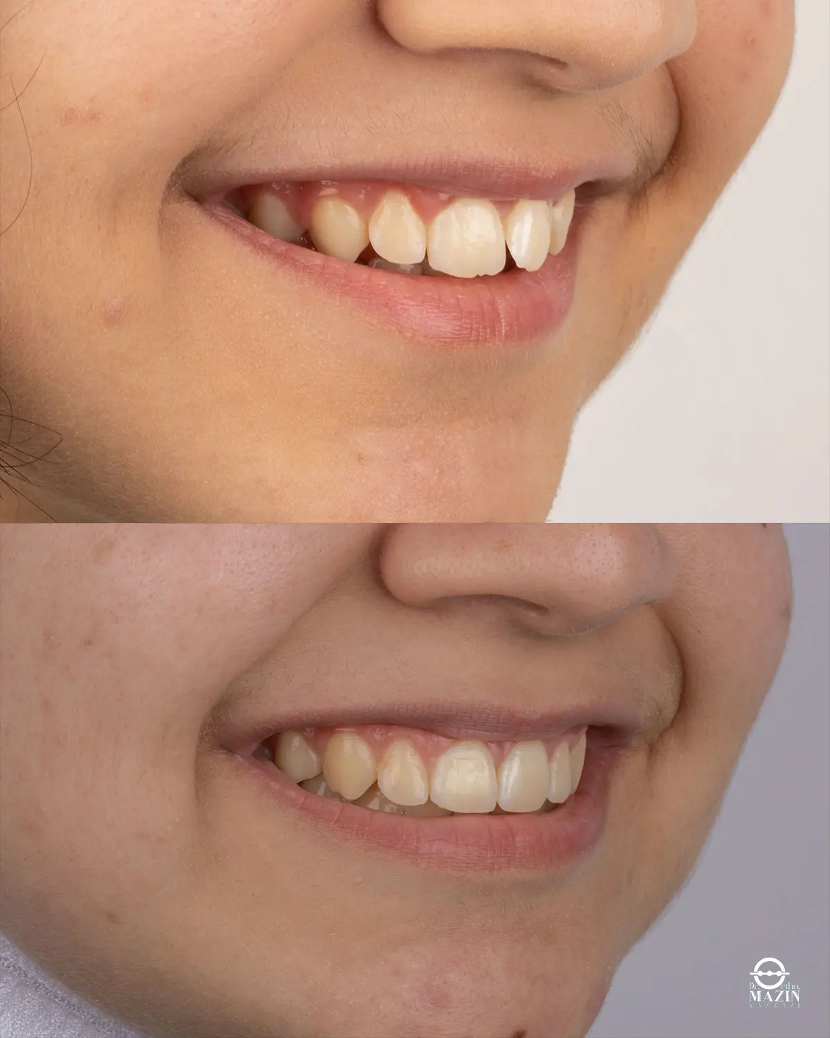 Before Image