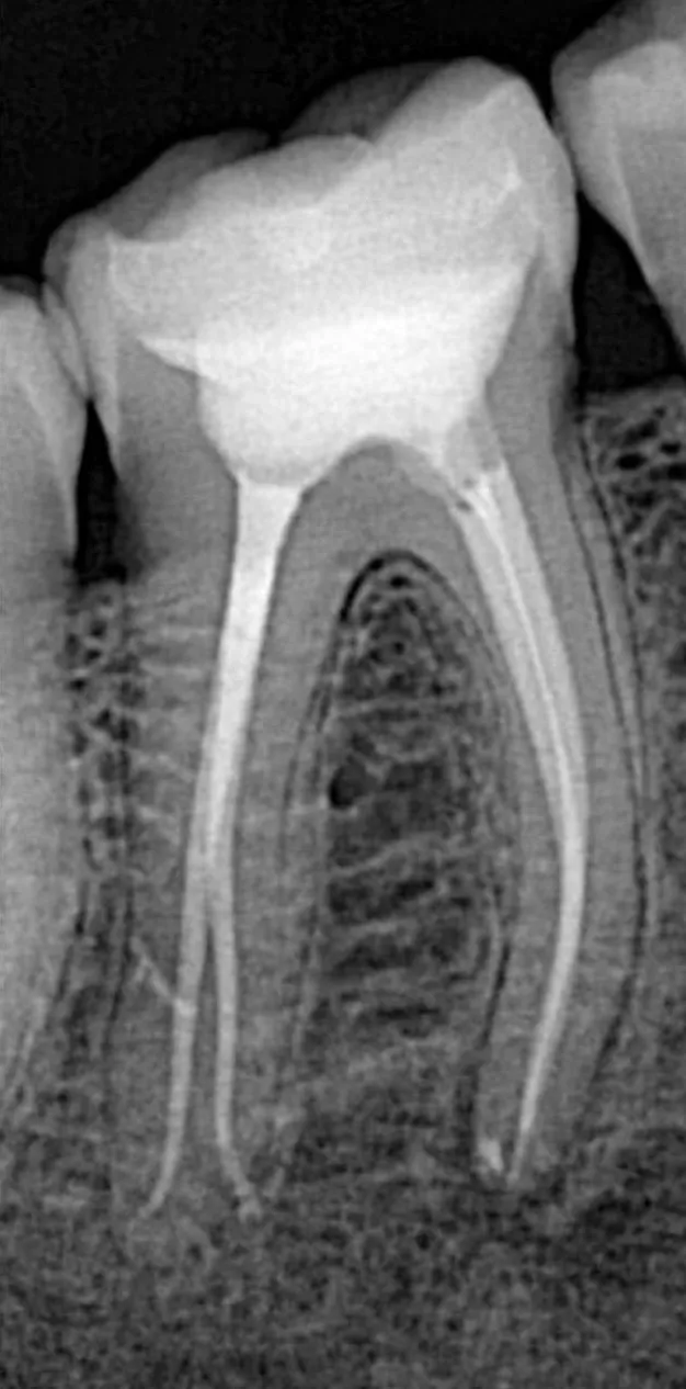 dr-mujtaba-2-after.webp