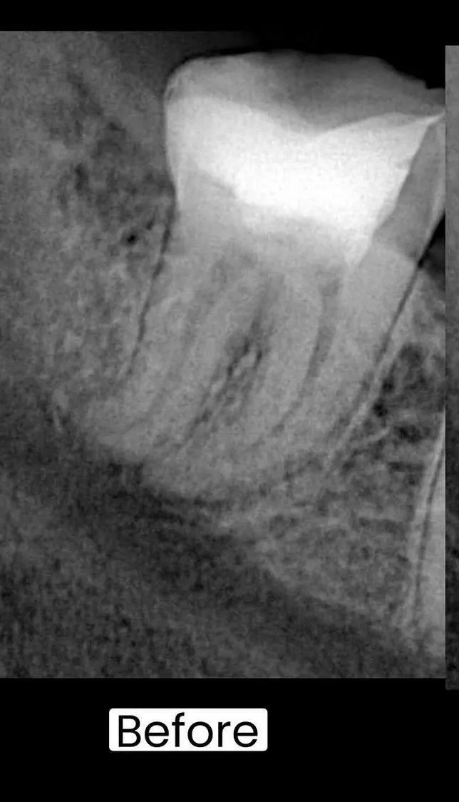 Before Image