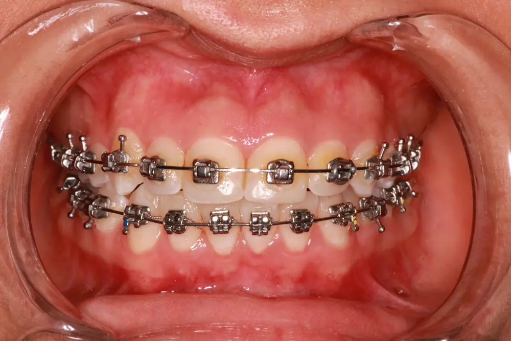 dr-muthana-1-after.webp