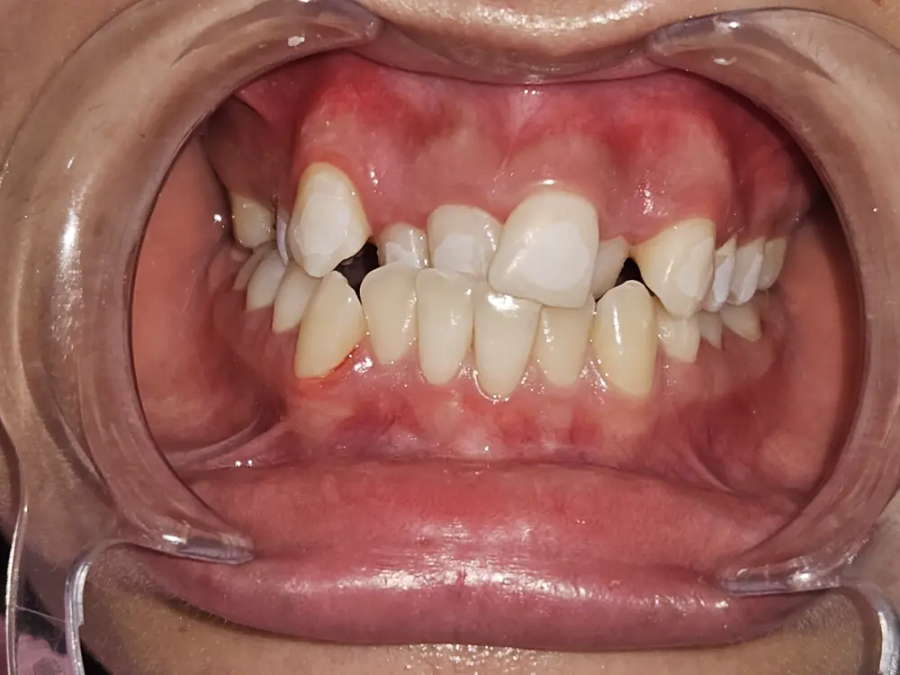 Before Image