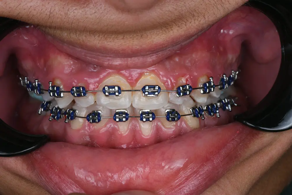 dr-muthana-2-after.webp