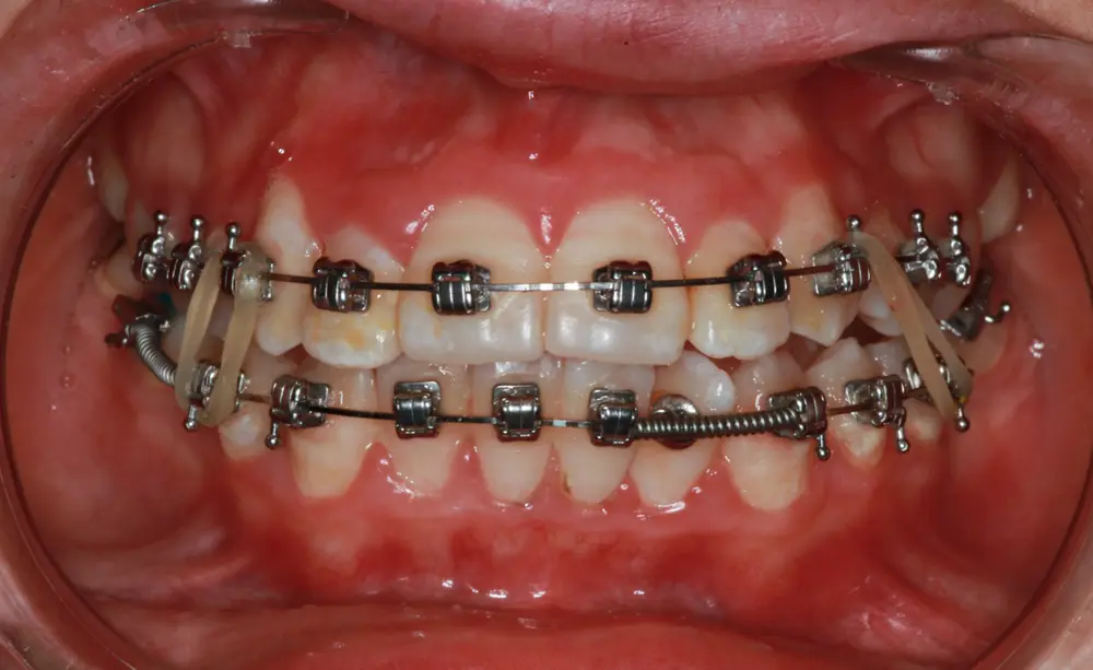 dr-muthana-4-after.webp