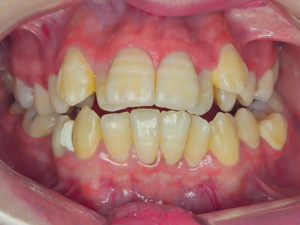 Before Image