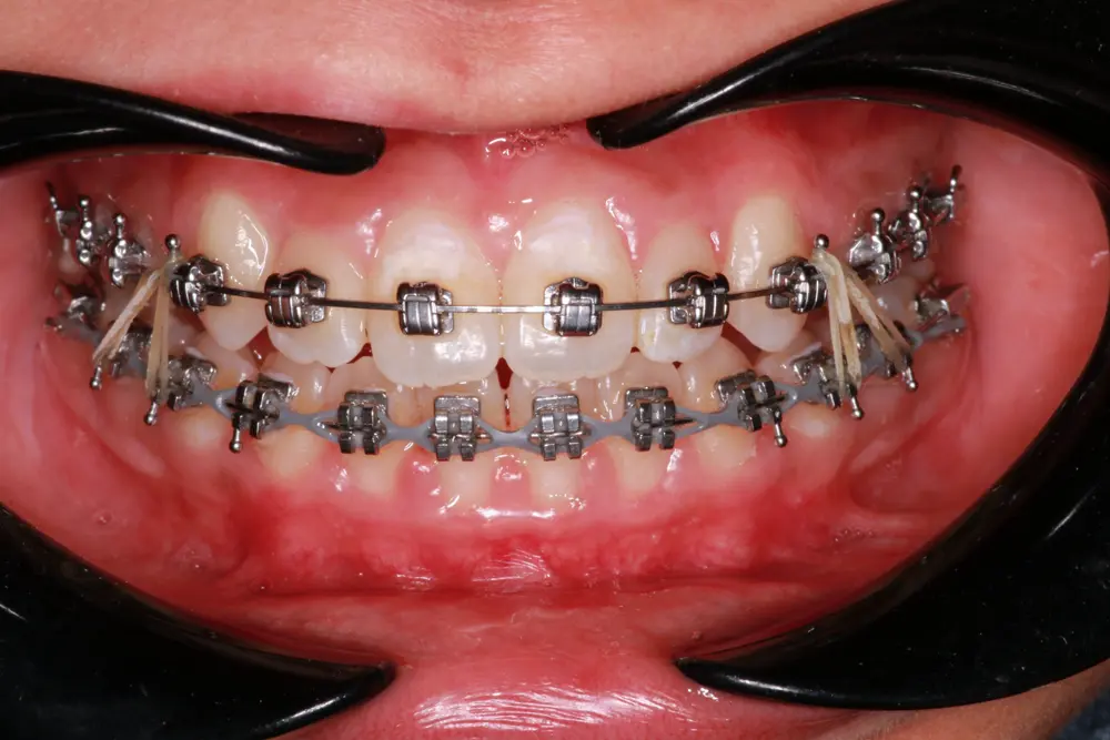 dr-muthana-5-after.webp