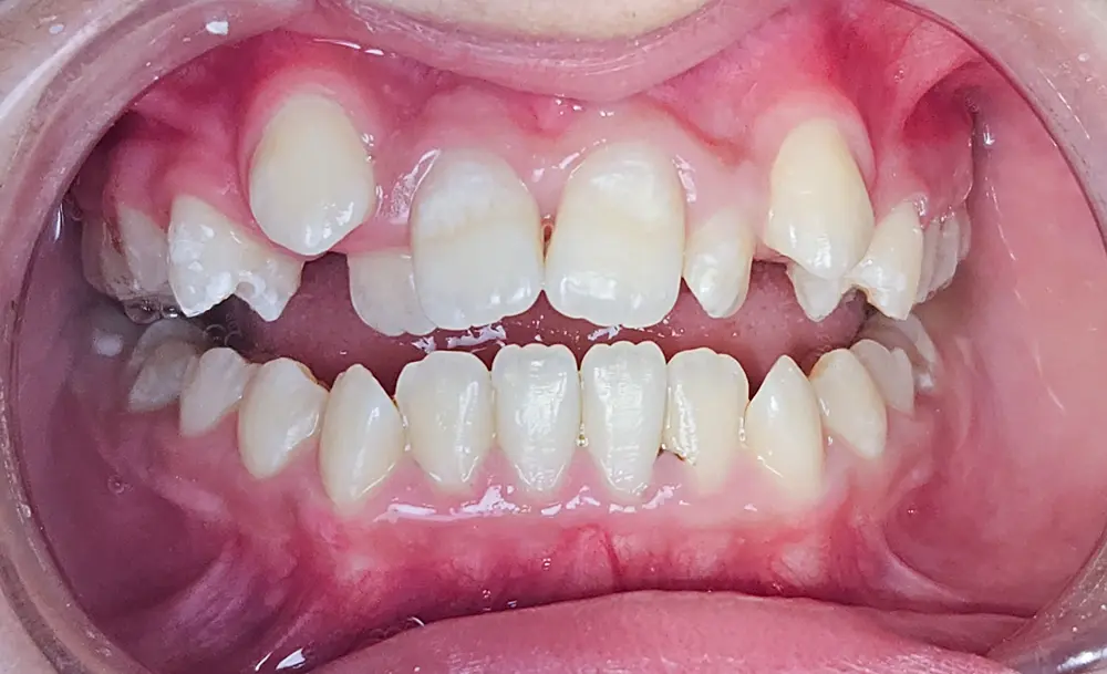 Before Image