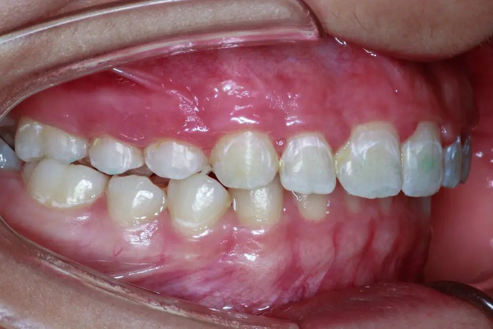 dr-muthana-6-after.webp