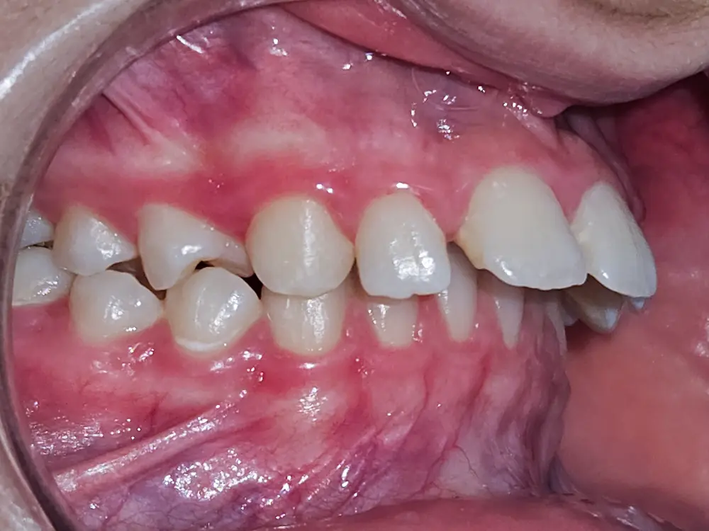 Before Image