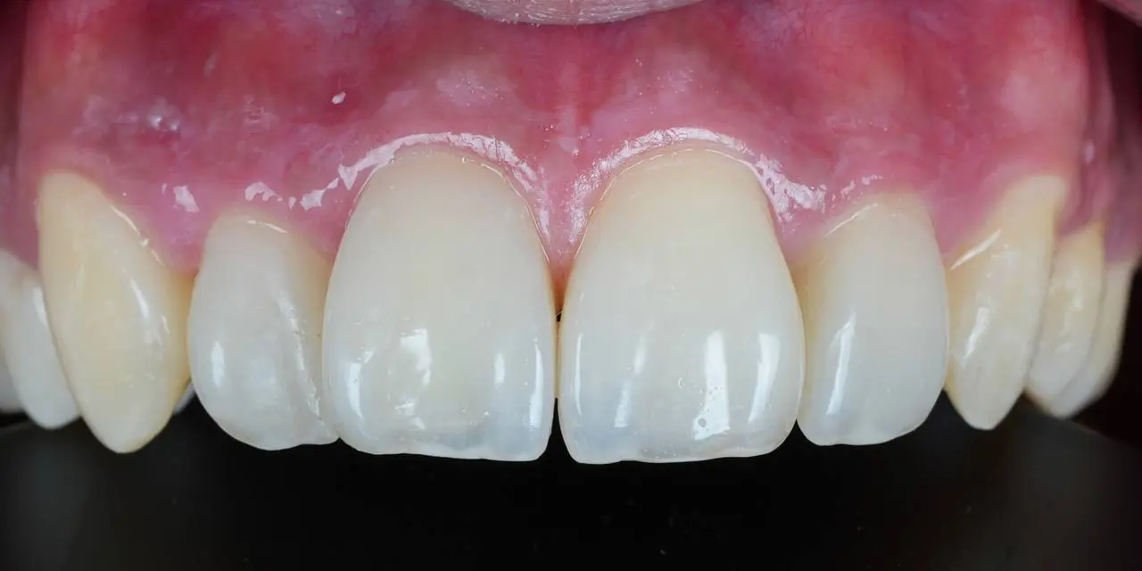 After Image